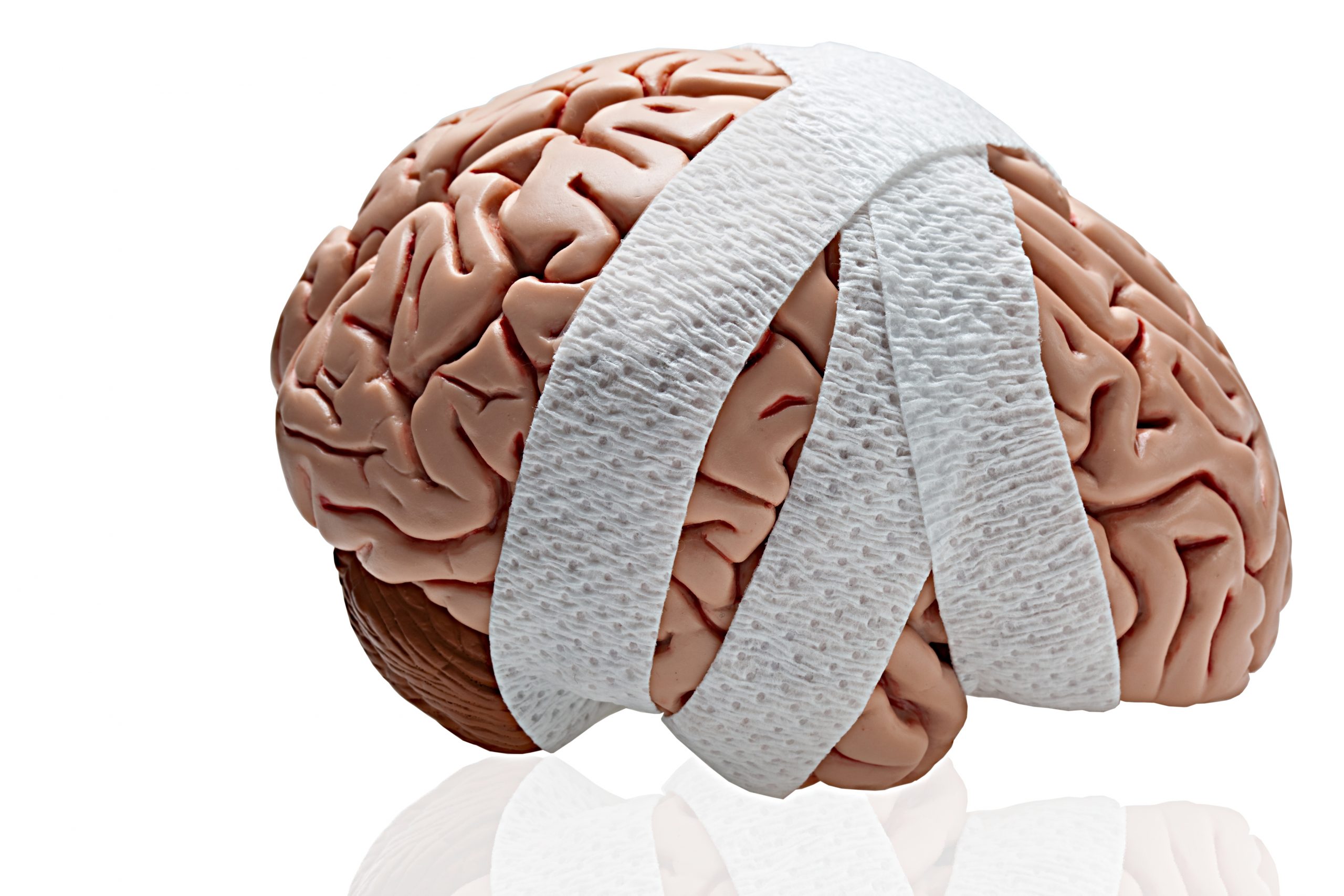 What Is Considered A Serious Brain Injury